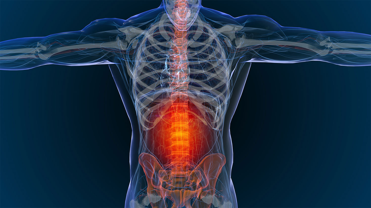 Disc Herniation & Bulging Relief - Ocean Integrated Wellness Center of Toms  River NJ